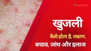 खुजली / स्केबीज (Scabies) क्या है, कैसे होता है, लक्षण, बचाव, जांच और इलाज