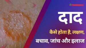 दाद क्या है, कैसे होता है, लक्षण, बचाव, जांच और इलाज